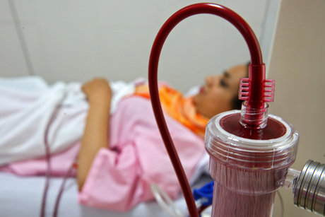 ۹۰۰ بیمار دیالیزی سیستان و بلوچستان منتظر پیوند کلیه